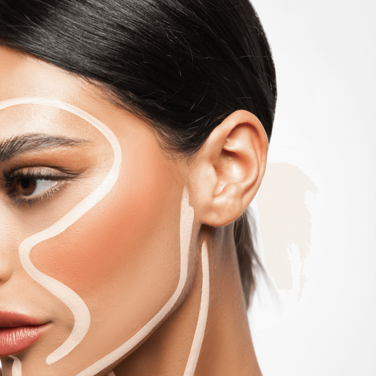Otoplastica
